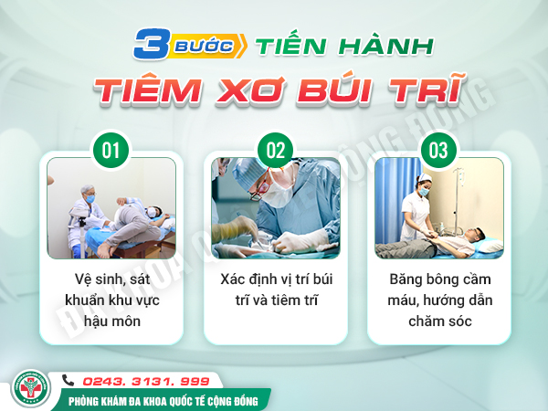 Tiết Lộ Sự Thật Ít Ai Biết Về Việc Thực Hiện Tiêm Búi Trĩ