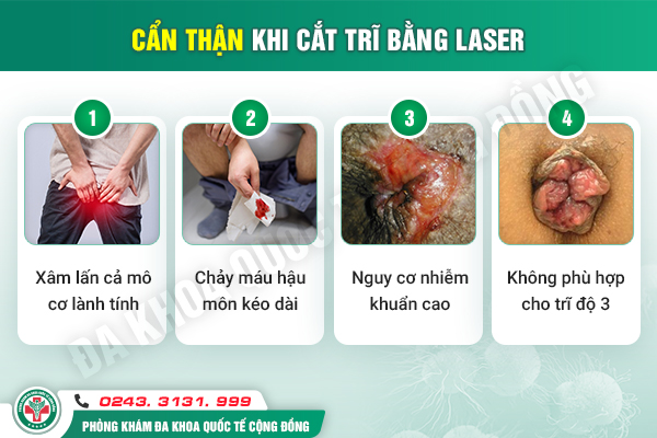 Review thật: Cắt trĩ bằng laser và những bài học đắt giá
