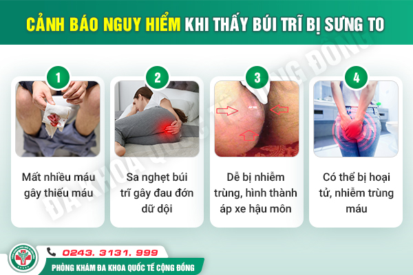 Búi trĩ sưng đau – Dấu hiệu cảnh báo cơ thể đang cầu cứu!