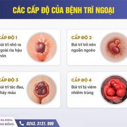 https://phongkhambenhtri.vn/wp-content/uploads/2024/09/photo_2024-09-30_08-46-51-3-250x250.jpg