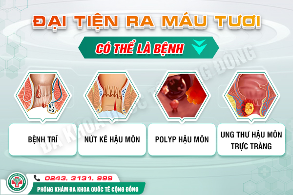 Cách chữa đi ngoài ra máu – chữa sớm, khỏi nhanh nhờ 3 nguyên tắc sau