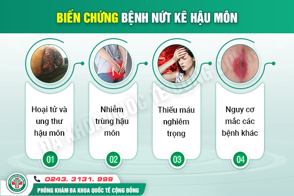 Nứt kẽ hậu môn có nguy hiểm không?
