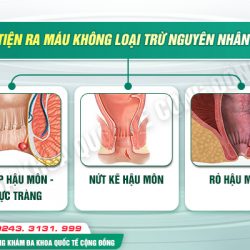 https://phongkhambenhtri.vn/wp-content/uploads/2024/10/5-Tan-1-250x250.jpg