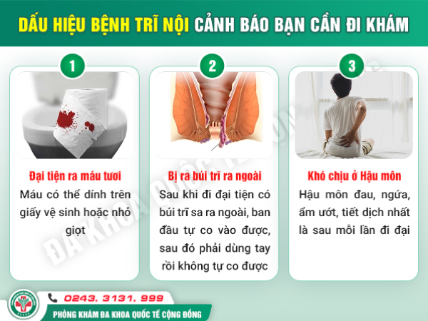 Cắt trĩ nội và những điều cần biết