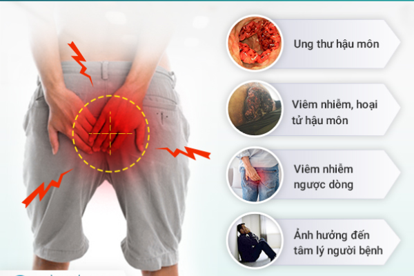 biến chứng của sa hậu môn