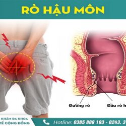 https://phongkhambenhtri.vn/wp-content/uploads/2024/10/ro-hau-mon-250x250.jpg