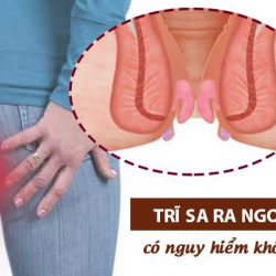 https://phongkhambenhtri.vn/wp-content/uploads/2024/10/sa-bui-tri-nguy-hiem-250x250.png