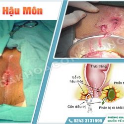 https://phongkhambenhtri.vn/wp-content/uploads/2024/10/tri-congdong-02-1-250x250.jpg