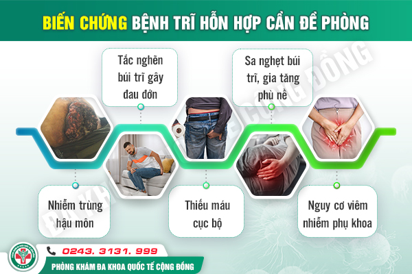 Có cần cắt trĩ hỗn hợp không và cắt bằng cách nào?