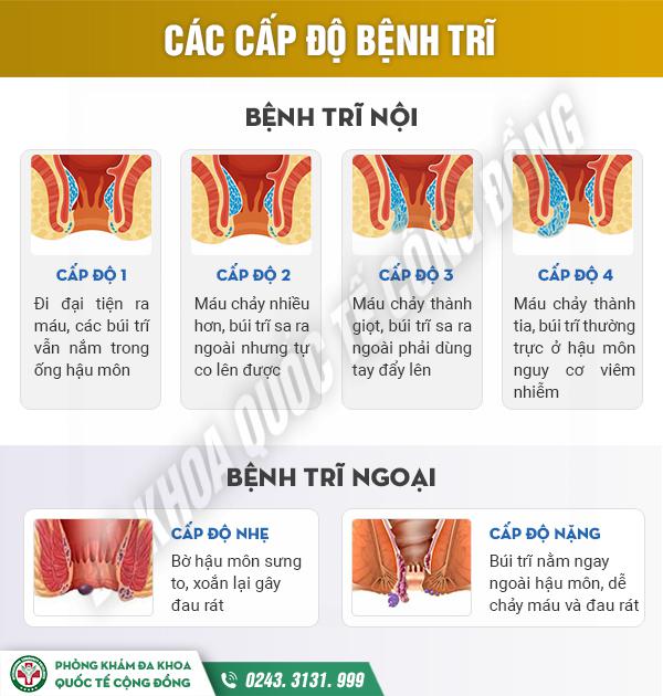 Đa khoa Quốc tế Cộng Đồng – Cơ sở điều trị bệnh trĩ hàng đầu miền Bắc