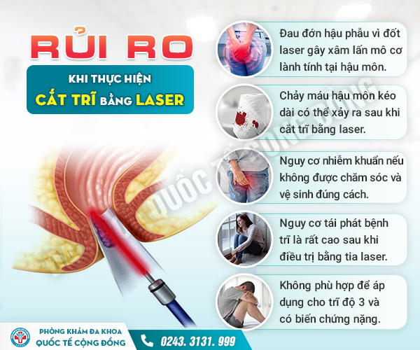 Phương Pháp Đốt Trĩ Laser: Giải Pháp Hoàn Hảo Hay Chỉ Là Lời Quảng Cáo?