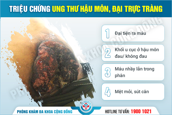 Hậu môn có cục thịt thừa có phải là bệnh không?